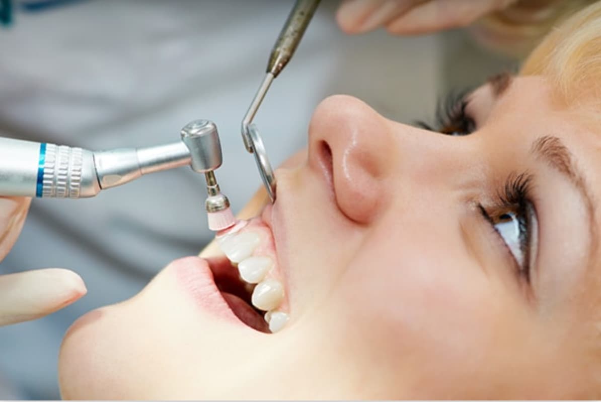 Ultrasonic dental cleaning